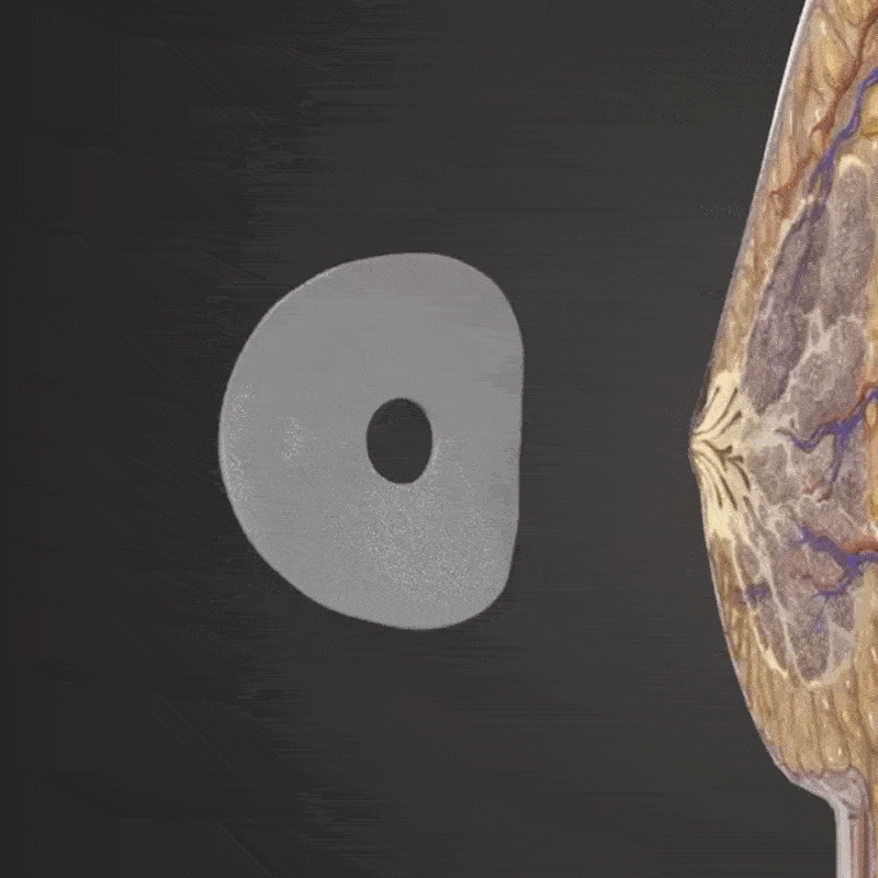 Healrize® 10-Pack Natural Breast Enhancement Patches